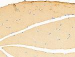 ACTA1 Antibody in Immunohistochemistry (Paraffin) (IHC (P))