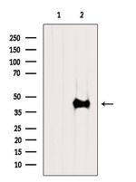 ACTA1 Antibody in Western Blot (WB)