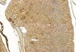 FAP Antibody in Immunohistochemistry (Paraffin) (IHC (P))