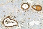 FAP Antibody in Immunohistochemistry (Paraffin) (IHC (P))