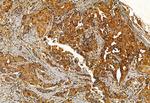 FAP Antibody in Immunohistochemistry (Paraffin) (IHC (P))