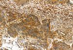 FAP Antibody in Immunohistochemistry (Paraffin) (IHC (P))