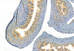 FAP Antibody in Immunohistochemistry (Paraffin) (IHC (P))