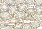 FAP Antibody in Immunohistochemistry (Paraffin) (IHC (P))