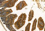 FAP Antibody in Immunohistochemistry (Paraffin) (IHC (P))