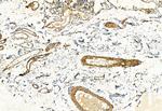 FAP Antibody in Immunohistochemistry (Paraffin) (IHC (P))