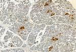 FAP Antibody in Immunohistochemistry (Paraffin) (IHC (P))