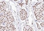 CDKN2C Antibody in Immunohistochemistry (Paraffin) (IHC (P))