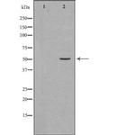 Phospho-hnRNP K (Ser284) Antibody in Western Blot (WB)