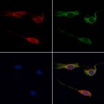 HTR1A Antibody in Immunocytochemistry (ICC/IF)