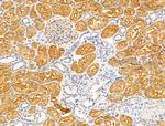 GLUT3 Antibody in Immunohistochemistry (Paraffin) (IHC (P))