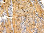 GLUT3 Antibody in Immunohistochemistry (Paraffin) (IHC (P))