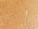 GLUT3 Antibody in Immunohistochemistry (Paraffin) (IHC (P))