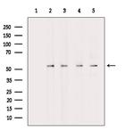 GLUT3 Antibody in Western Blot (WB)