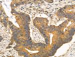 RhoH Antibody in Immunohistochemistry (Paraffin) (IHC (P))