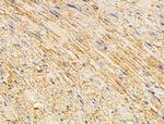 RhoH Antibody in Immunohistochemistry (Paraffin) (IHC (P))