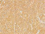 RhoH Antibody in Immunohistochemistry (Paraffin) (IHC (P))