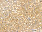 RhoH Antibody in Immunohistochemistry (Paraffin) (IHC (P))