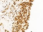 Ku70/Ku80 Antibody in Immunohistochemistry (Paraffin) (IHC (P))