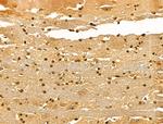 Ku70/Ku80 Antibody in Immunohistochemistry (Paraffin) (IHC (P))