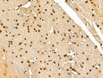 Ku70/Ku80 Antibody in Immunohistochemistry (Paraffin) (IHC (P))