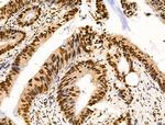 Ku70/Ku80 Antibody in Immunohistochemistry (Paraffin) (IHC (P))