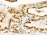 Ku70/Ku80 Antibody in Immunohistochemistry (Paraffin) (IHC (P))