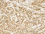 Ku70/Ku80 Antibody in Immunohistochemistry (Paraffin) (IHC (P))