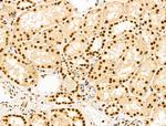 Ku70/Ku80 Antibody in Immunohistochemistry (Paraffin) (IHC (P))