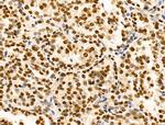 Ku70/Ku80 Antibody in Immunohistochemistry (Paraffin) (IHC (P))