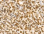 Ku70/Ku80 Antibody in Immunohistochemistry (Paraffin) (IHC (P))