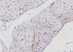 Ku70/Ku80 Antibody in Immunohistochemistry (Paraffin) (IHC (P))