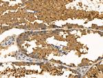 HDAC10 Antibody in Immunohistochemistry (Paraffin) (IHC (P))