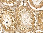 HDAC10 Antibody in Immunohistochemistry (Paraffin) (IHC (P))