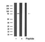 HDAC10 Antibody in Western Blot (WB)