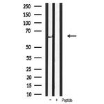 PDPK1 Antibody in Western Blot (WB)