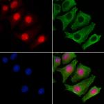 PDPK1 Antibody in Immunocytochemistry (ICC/IF)