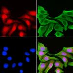 MiTF Antibody in Immunocytochemistry (ICC/IF)