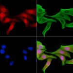 MiTF Antibody in Immunocytochemistry (ICC/IF)