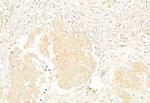 MiTF Antibody in Immunohistochemistry (Paraffin) (IHC (P))