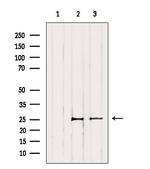 TK1 Antibody in Western Blot (WB)