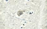 ATP1A1 Antibody in Immunohistochemistry (Paraffin) (IHC (P))