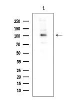 RB1 Antibody in Western Blot (WB)