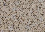 RB1 Antibody in Immunohistochemistry (Paraffin) (IHC (P))