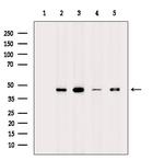 hnRNP C1/C2 Antibody in Western Blot (WB)