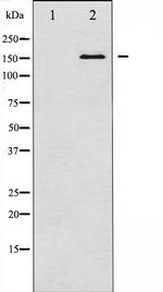 Bcr Antibody in Western Blot (WB)