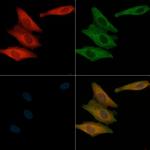 VAV1 Antibody in Immunocytochemistry (ICC/IF)