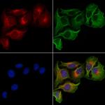 PLCG1 Antibody in Immunocytochemistry (ICC/IF)