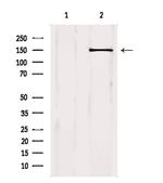 PLCG1 Antibody in Western Blot (WB)