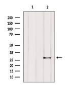 Cardiac Troponin I Antibody in Western Blot (WB)